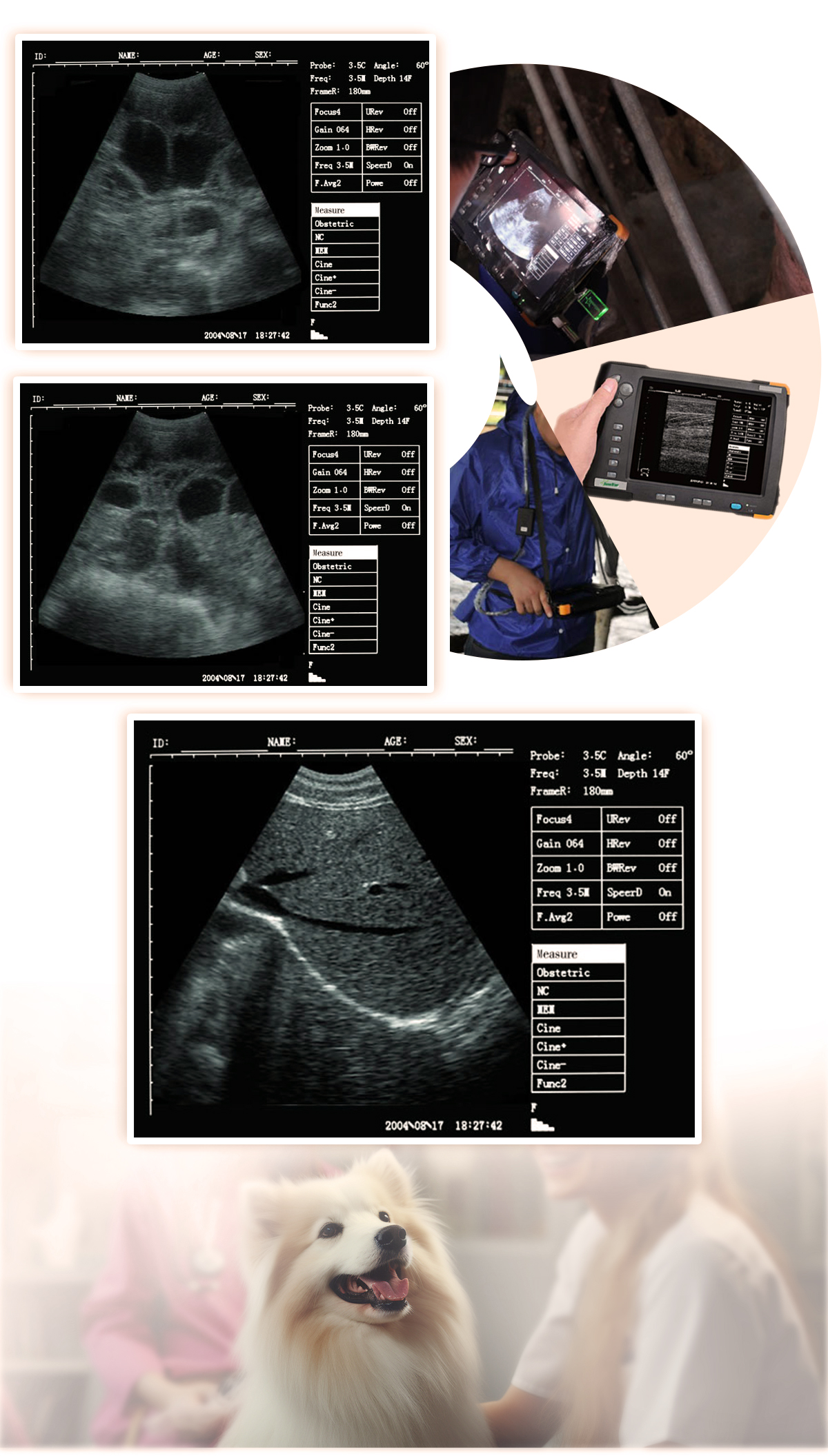 V5超声产品详情页 09